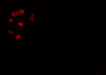 ZNF596 Antibody - Staining HeLa cells by IF/ICC. The samples were fixed with PFA and permeabilized in 0.1% Triton X-100, then blocked in 10% serum for 45 min at 25°C. The primary antibody was diluted at 1:200 and incubated with the sample for 1 hour at 37°C. An Alexa Fluor 594 conjugated goat anti-rabbit IgG (H+L) antibody, diluted at 1/600, was used as secondary antibody.