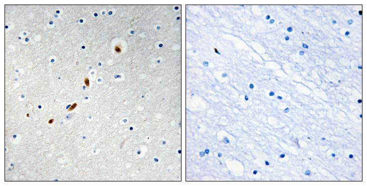 ZNF596 Antibody - Peptide - + Immunohistochemistry analysis of paraffin-embedded human brain tissue using ZNF596 antibody.