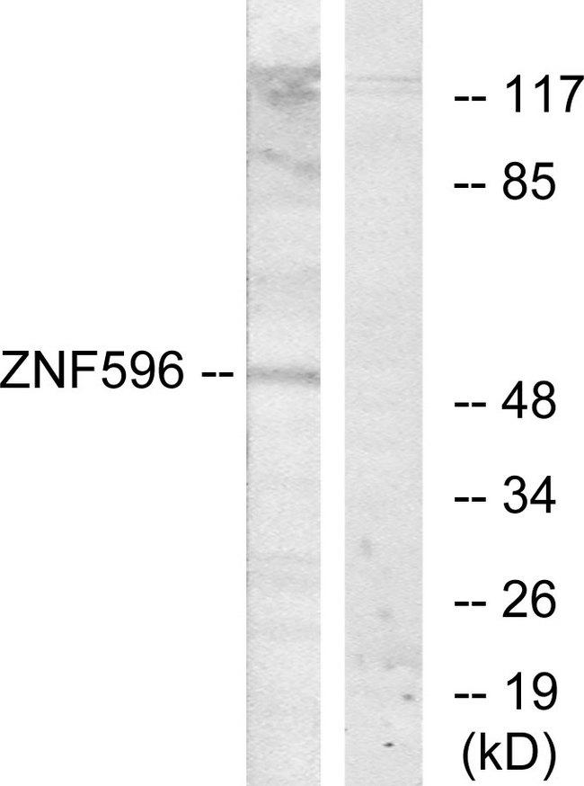 ZNF596 Antibody - Western blot analysis of extracts from Jurkat cells, using ZNF596 antibody.