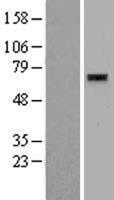 ZNF596 Protein - Western validation with an anti-DDK antibody * L: Control HEK293 lysate R: Over-expression lysate