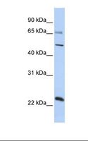 ZNF597 Antibody - Placenta lysate. Antibody concentration: 1.0 ug/ml. Gel concentration: 12%.  This image was taken for the unconjugated form of this product. Other forms have not been tested.