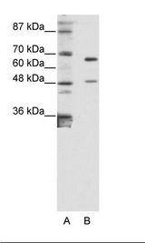 ZNF597 Antibody - A: Marker, B: Jurkat Cell Lysate.  This image was taken for the unconjugated form of this product. Other forms have not been tested.