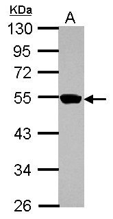 ZNF597 Antibody - Sample (30 ug of whole cell lysate) A: A431 10% SDS PAGE ZNF597 antibody diluted at 1:1000