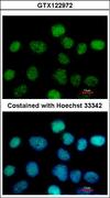 ZNF597 Antibody - Immunofluorescence of paraformaldehyde-fixed A431, using ZNF597 antibody at 1:500 dilution.
