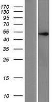 ZNF597 Protein - Western validation with an anti-DDK antibody * L: Control HEK293 lysate R: Over-expression lysate
