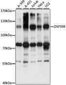 ZNF598 Antibody - Western blot analysis of extracts of various cell lines, using ZNF598 antibody at 1:1000 dilution. The secondary antibody used was an HRP Goat Anti-Rabbit IgG (H+L) at 1:10000 dilution. Lysates were loaded 25ug per lane and 3% nonfat dry milk in TBST was used for blocking. An ECL Kit was used for detection and the exposure time was 15S.