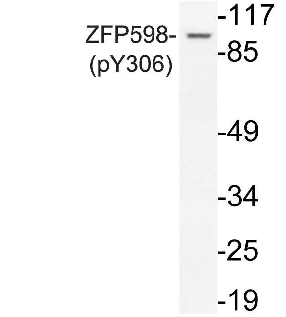 ZNF598 Antibody - Western blot analysis of lysate from Jurkat cells, uisng phospho-ZFP598 (Phospho-Tyr306) antibody.