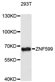 ZNF599 Antibody - Western blot analysis of extracts of 293T cells, using ZNF599 antibody at 1:3000 dilution. The secondary antibody used was an HRP Goat Anti-Rabbit IgG (H+L) at 1:10000 dilution. Lysates were loaded 25ug per lane and 3% nonfat dry milk in TBST was used for blocking. An ECL Kit was used for detection and the exposure time was 90s.