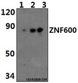 ZNF600 Antibody - Western blot of ZNF600 polyclonal antibody at 1:500 dilution. Lane 1: MCF-7 whole cell lysate (40 ug). Lane 2: H9C2 whole cell lysate (40 ug). Lane 3: RAW264.7 whole cell lysate (40 ug).