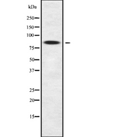 ZNF600 Antibody - Western blot analysis of ZNF600 using K562 whole cells lysates