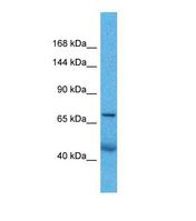 ZNF606 Antibody - Western blot of Human Lung Tumor. ZNF606 antibody dilution 1.0 ug/ml.  This image was taken for the unconjugated form of this product. Other forms have not been tested.