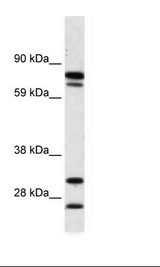 ZNF606 Antibody - Fetal Kidney Lysate.  This image was taken for the unconjugated form of this product. Other forms have not been tested.