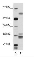 ZNF607 Antibody - A: Marker, B: Jurkat Cell Lysate.  This image was taken for the unconjugated form of this product. Other forms have not been tested.