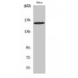 ZNF608 Antibody - Western blot of ZNF608 antibody