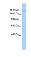 ZNF608 Antibody - ZNF608 antibody Western blot of HeLa lysate. This image was taken for the unconjugated form of this product. Other forms have not been tested.