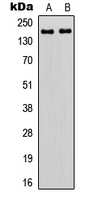 ZNF608 Antibody - Western blot analysis of ZNF608 expression in HEK293T (A); HeLa (B) whole cell lysates.