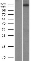 ZNF609 Protein - Western validation with an anti-DDK antibody * L: Control HEK293 lysate R: Over-expression lysate