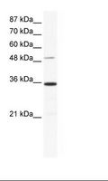 ZNF610 Antibody - HepG2 Cell Lysate.  This image was taken for the unconjugated form of this product. Other forms have not been tested.