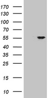 ZNF610 Antibody - HEK293T cells were transfected with the pCMV6-ENTRY control. (Left lane) or pCMV6-ENTRY ZNF610. (Right lane) cDNA for 48 hrs and lysed. Equivalent amounts of cell lysates. (5 ug per lane) were separated by SDS-PAGE and immunoblotted with anti-ZNF610. (1:500)