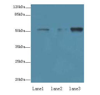 ZNF610 Antibody - Western blot. All lanes: ZNF610 antibody at 7 ug/ml. Lane 1: HepG-2 whole cell lysate. Lane 2: HeLa whole cell lysate. Lane 3: MCF7 whole cell lysate. Secondary antibody: Goat polyclonal to Rabbit IgG at 1:10000 dilution. Predicted band size: 53 kDa. Observed band size: 53 kDa.
