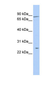 ZNF613 Antibody - ZNF613 antibody Western blot of Jurkat lysate. This image was taken for the unconjugated form of this product. Other forms have not been tested.