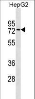 ZNF614 Antibody - ZNF614 Antibody western blot of HepG2 cell line lysates (35 ug/lane). The ZNF614 antibody detected the ZNF614 protein (arrow).