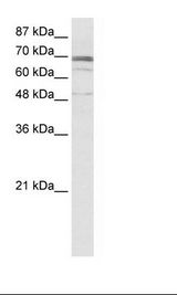 ZNF614 Antibody - Jurkat Cell Lysate.  This image was taken for the unconjugated form of this product. Other forms have not been tested.