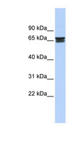 ZNF614 Antibody - ZNF614 antibody Western blot of Fetal Heart lysate. This image was taken for the unconjugated form of this product. Other forms have not been tested.