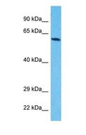 ZNF614 Antibody - Western blot of ZN614 Antibody with human HepG2 Whole Cell lysate.  This image was taken for the unconjugated form of this product. Other forms have not been tested.