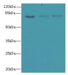 ZNF614 Antibody - Western blot. All lanes: ZNF614 antibody at 6 ug/ml. Lane 1: Jurkat whole cell lysate. Lane 2: HepG-2 whole cell lysate. Lane 3: A549 whole cell lysate. Secondary Goat polyclonal to Rabbit IgG at 1:10000 dilution. Predicted band size: 67 kDa. Observed band size: 67 kDa.