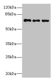 ZNF614 Antibody - Western blot All lanes: ZNF614 antibody at 6µg/ml Lane 1: Jurkat whole cell lysate Lane 2: HepG2 whole cell lysate Lane 3: A549 whole cell lysate Secondary Goat polyclonal to rabbit IgG at 1/10000 dilution Predicted band size: 68, 23 kDa Observed band size: 68 kDa