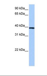 ZNF618 Antibody - NTERA2 cell lysate. Antibody concentration: 0.5 ug/ml. Gel concentration: 12%.  This image was taken for the unconjugated form of this product. Other forms have not been tested.