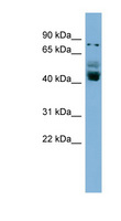 ZNF620 Antibody - ZNF620 antibody Western blot of NCI-H226 cell lysate. This image was taken for the unconjugated form of this product. Other forms have not been tested.