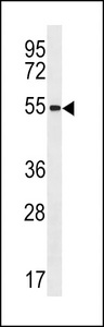 ZNF621 Antibody - ZNF621 Antibody western blot of MDA-MB468 cell line lysates (35 ug/lane). The ZNF621 antibody detected the ZNF621 protein (arrow).
