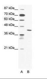 ZNF621 Antibody - A: Marker, B: Jurkat Cell Lysate.  This image was taken for the unconjugated form of this product. Other forms have not been tested.