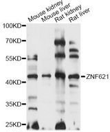 ZNF621 Antibody - Western blot analysis of extracts of various cell lines, using ZNF621 antibody at 1:1000 dilution. The secondary antibody used was an HRP Goat Anti-Rabbit IgG (H+L) at 1:10000 dilution. Lysates were loaded 25ug per lane and 3% nonfat dry milk in TBST was used for blocking. An ECL Kit was used for detection and the exposure time was 10s.