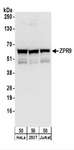 ZNF622 Antibody - Detection of Human ZPR9 by Western Blot. Samples: Whole cell lysate (50 ug) from HeLa, 293T, and Jurkat cells. Antibodies: Affinity purified rabbit anti-ZPR9 antibody used for WB at 0.1 ug/ml. Detection: Chemiluminescence with an exposure time of 10 seconds.