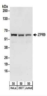 ZNF622 Antibody - Detection of Human ZPR9 by Western Blot. Samples: Whole cell lysate (50 ug) from HeLa, 293T, and Jurkat cells. Antibodies: Affinity purified rabbit anti-ZPR9 antibody used for WB at 0.1 ug/ml. Detection: Chemiluminescence with an exposure time of 30 seconds.