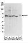 ZNF622 Antibody - Detection of Human and Mouse ZPR9 by Western Blot. Samples: Whole cell lysate (50 ug) from HeLa, 293T, Jurkat, mouse TCMK-1, and mouse NIH3T3 cells. Antibodies: Affinity purified rabbit anti-ZPR9 antibody used for WB at 0.4 ug/ml. Detection: Chemiluminescence with an exposure time of 10 seconds.
