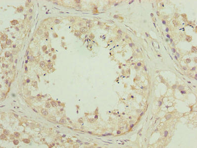 ZNF622 Antibody - Immunohistochemistry of paraffin-embedded human testis tissue using ZNF622 Antibody at dilution of 1:100