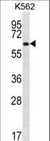 ZNF623 Antibody - ZNF623 Antibody western blot of K562 cell line lysates (35 ug/lane). The ZNF623 antibody detected the ZNF623 protein (arrow).