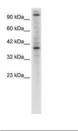 ZNF624 Antibody - Jurkat Cell Lysate.  This image was taken for the unconjugated form of this product. Other forms have not been tested.