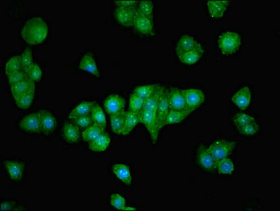 ZNF624 Antibody - Immunofluorescent analysis of PC-3 cells using ZNF624 Antibody at dilution of 1:100 and Alexa Fluor 488-congugated AffiniPure Goat Anti-Rabbit IgG(H+L)