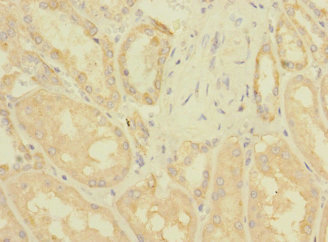 ZNF624 Antibody - Immunohistochemistry of paraffin-embedded human kidney tissue using ZNF624 Antibody at dilution of 1:100
