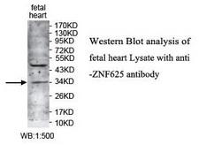 ZNF625 Antibody