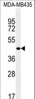 ZNF625 Antibody - ZNF625 Antibody western blot of MDA-MB435 cell line lysates (35 ug/lane). The ZNF625 antibody detected the ZNF625 protein (arrow).