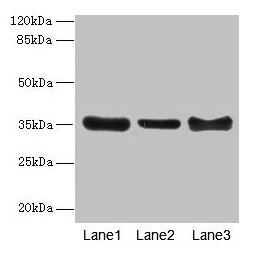 ZNF625 Antibody - Western blot All lanes: ZNF625 antibody at 4µg/ml Lane 1: Mouse brain tissue Lane 2: Mouse lung tissue Lane 3: Mouse ovarian tissue Secondary Goat polyclonal to rabbit IgG at 1/10000 dilution Predicted band size: 35, 43 kDa Observed band size: 35 kDa