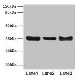 ZNF625 Antibody - Western blot All lanes: ZNF625 antibody at 4µg/ml Lane 1: Mouse brain tissue Lane 2: Mouse lung tissue Lane 3: Mouse ovarian tissue Secondary Goat polyclonal to rabbit IgG at 1/10000 dilution Predicted band size: 35, 43 kDa Observed band size: 35 kDa