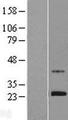 ZNF625 Protein - Western validation with an anti-DDK antibody * L: Control HEK293 lysate R: Over-expression lysate