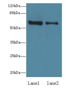 ZNF626 Antibody - Western blot. All lanes: ZNF626 antibody at 10 ug/ml. Lane 1: HepG-2 whole cell lysate. Lane 2: Raji whole cell lysate. Secondary antibody: Goat polyclonal to Rabbit IgG at 1:10000 dilution. Predicted band size: 61 kDa. Observed band size: 61 kDa.